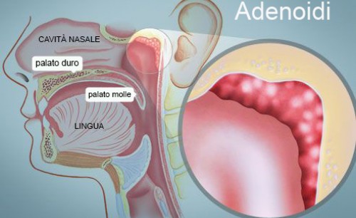 tonsille e adenoidi illustrazione anatomica